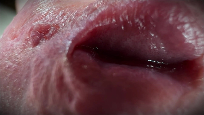 Leonardo-1974: Sperm Close-up Front
