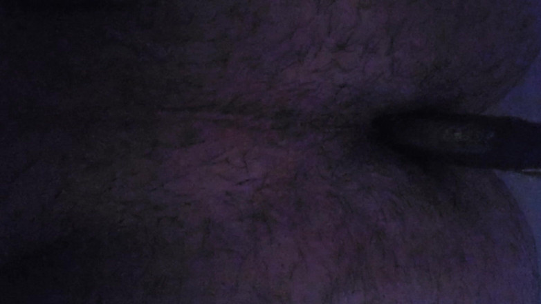 Azgnkurt: Götüme Tıraş Bıcağı Sokuyorum