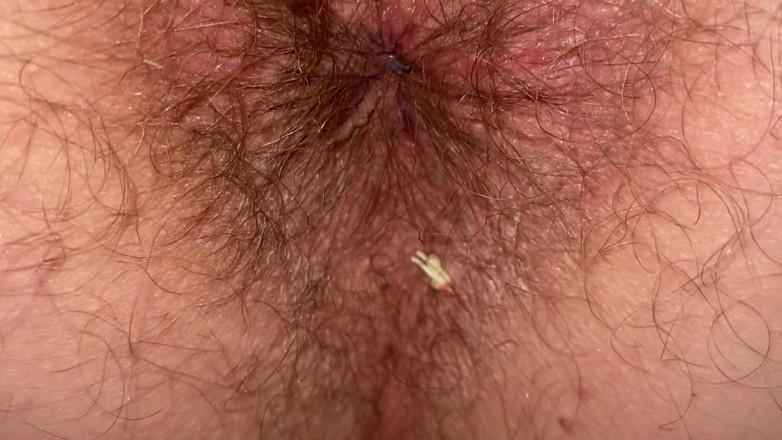 Cuteblonde666: Vidéo fétiche de géante, trou du cul poilu, gros plan...