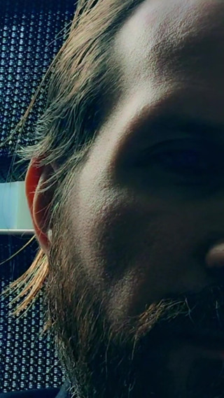 AlbinoAdonis: Up Close