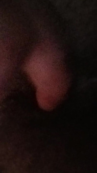 1000000331