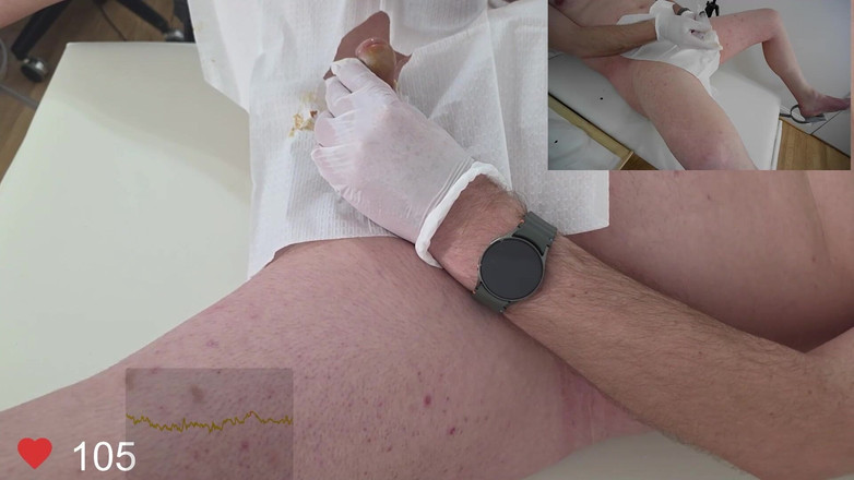 Clinical Climax: 16 Francouzská foley inzerce