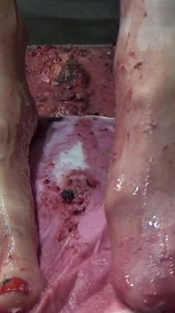 I Pee in Your Cake and Trample It with My Feet
