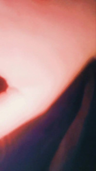 Solotease