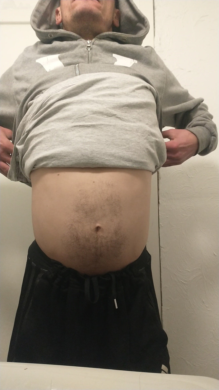 Fransis: Hậu môn nghiệp dư và teen