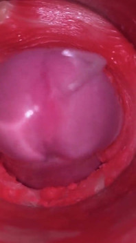 Caméra dans la chatte : éjaculation puissante dans la chatte ! Meilleur ASMR interne