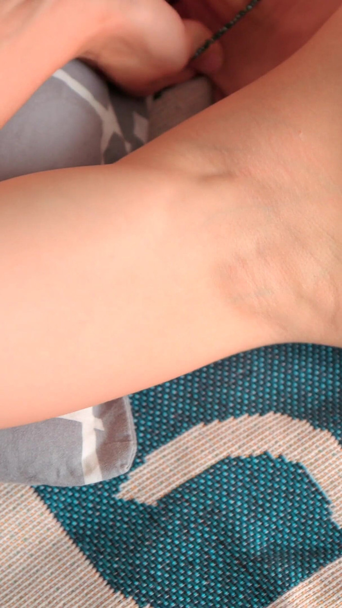 Melissa Burn: The Skin of My Armpits Is so Delicate
