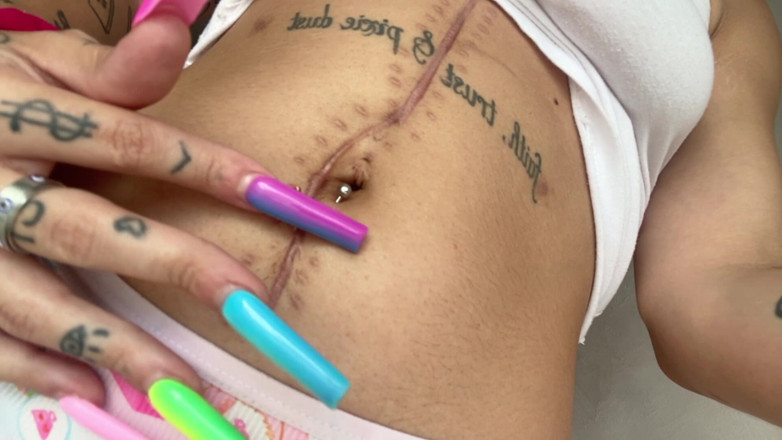 Nali Marie: Scar Fetish Belly Button Waist Tummy Skinny Teen Petite Flat...