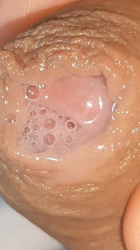Curious Close-up of Pre-cum in Flaccid Phimosis.