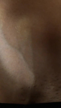 Abs Veins