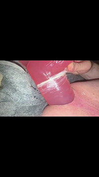 CD Anal Compilation of Gaping Stretching and Being Fucked by a Machine 2026