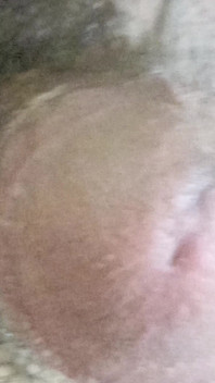 My Dick