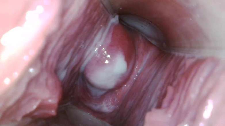 JANA studios: Endoscope in my pussy