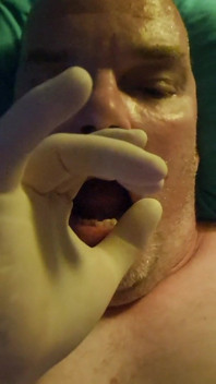 Nechceš Vyšetření Bradavek?