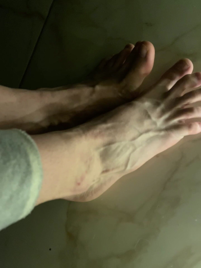 Princess Aisha: So Swollen Veins on the Feet