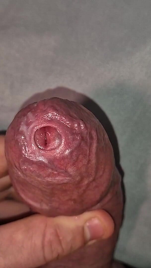 Close up on Phimosis Large Cock, so Hot! (Uncut quality)