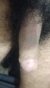 Deshidick0.m