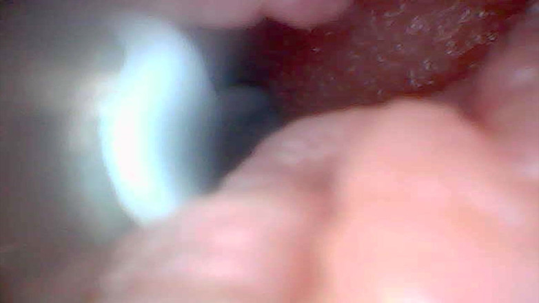 Twittiy: 보짓물 가득한 보지를 함께 엿보자(내시경 카메라)