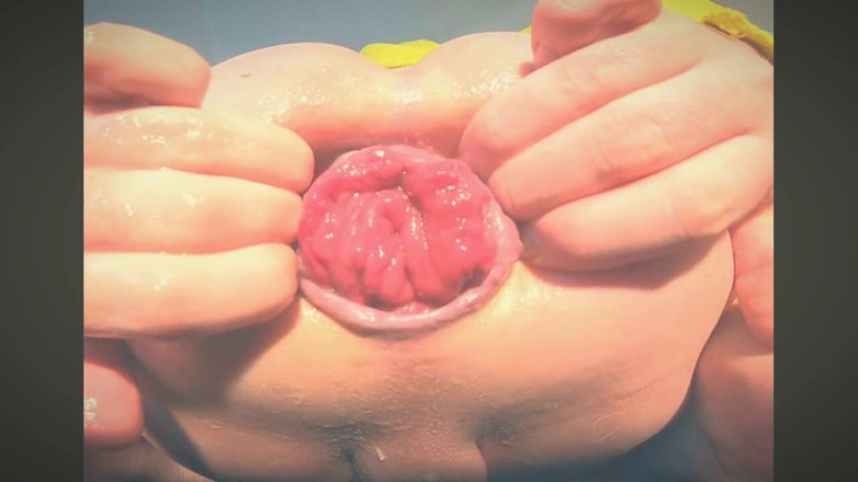 dolphinboy: 私のジューシーなお尻の穴と脱出症を指で弄る