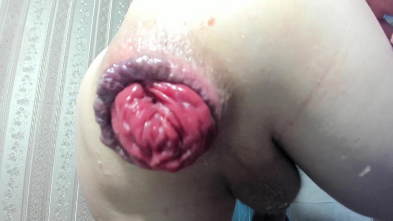 IncredibleGuy: Prolaps analku dientot habis-habisan pakai dildo