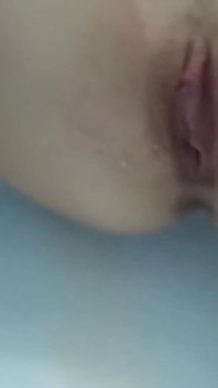 다리에 큰 타박상을 입은 마고 오줌