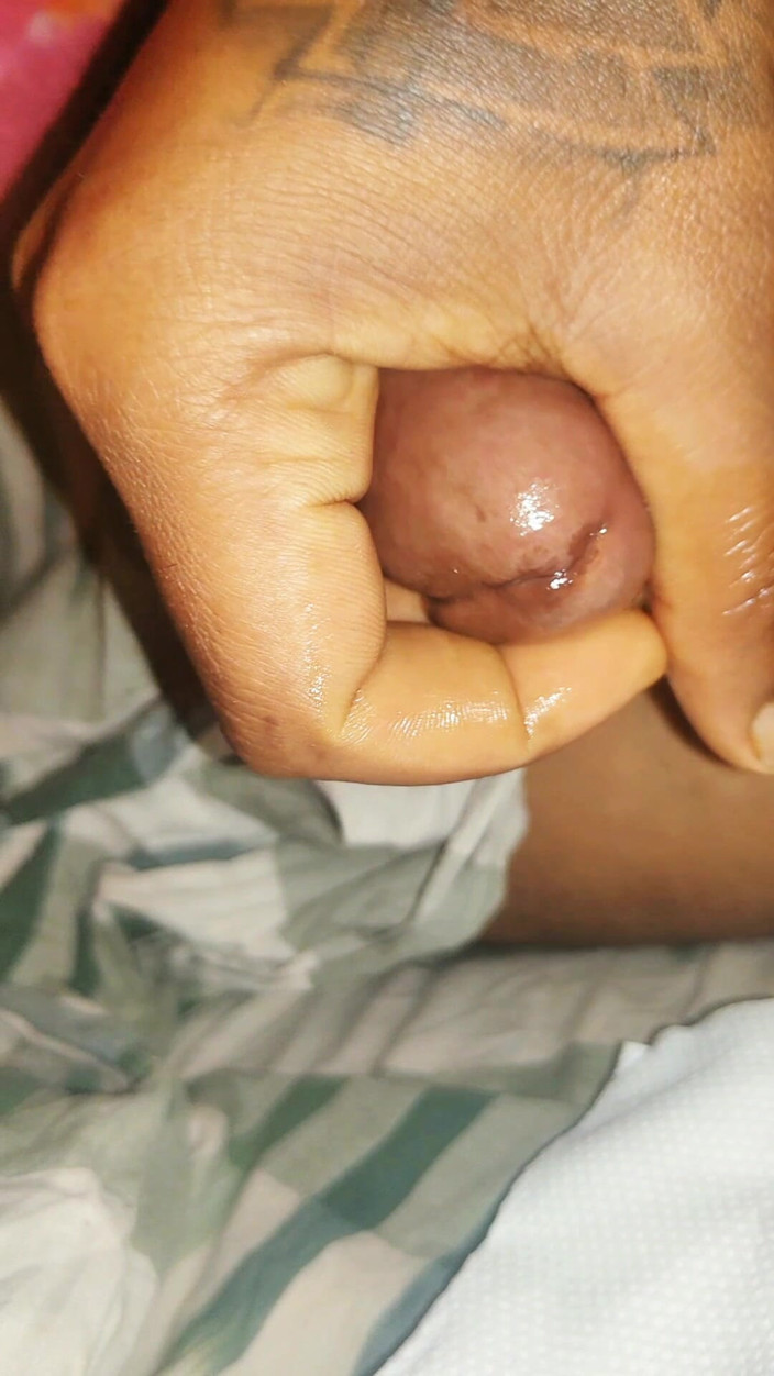 AnR: Masturbazione a Nigh