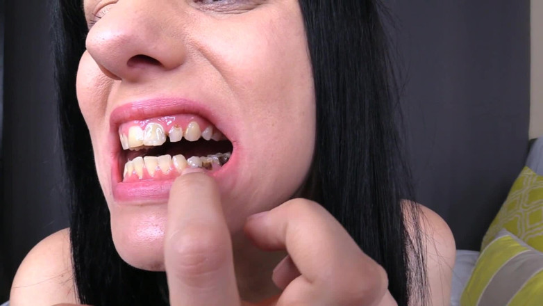 Quinn brooks: My Dental Journey