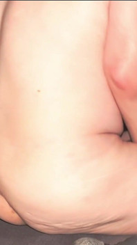 Smooth Skin
