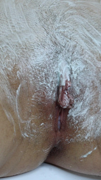 Hairy Pussy Shaving Close up! Intimate Haircut!