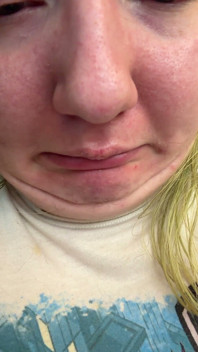 Chin Faces