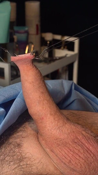 İğneler BDT'nin en iyi hali!