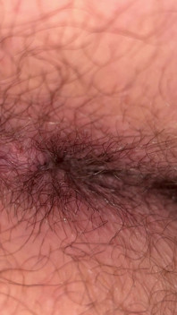 Close up Hairy Hole