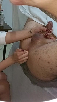 Il paziente va per un esame della prostata, ma finisce con uno strapon incastrato nel culo