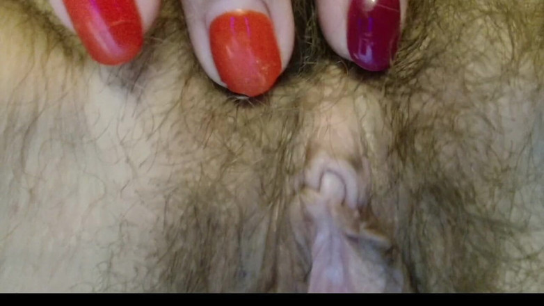 ANGELA_LADY: 毛むくじゃらのおまんこの辺縁穴はどんどん大きくなってきています