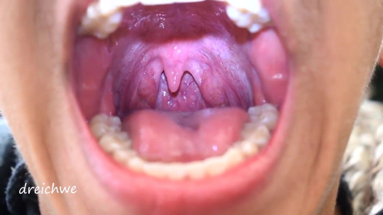 Dreichwe: Uvula fetiš ústa