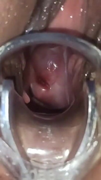 Masturbación con vista del útero y espéculo médico, cerca de mi coño