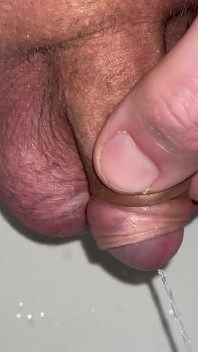 Kencing dan bermain dengan Forskin