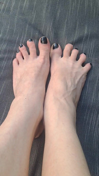 Do We See How Beguiled My Throbbing Foot Veins Are