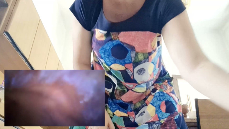 Nicoletta Embassi: Kamera pil berkumbang sambil berjalan di dalam perutku pov