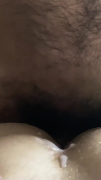 실습 치료