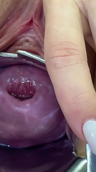 Glass Dildo Cervix Penetration