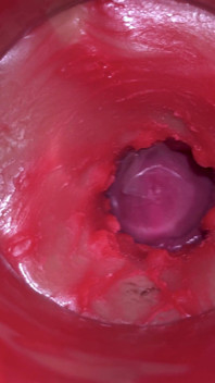 Camera Inside Pussy: Powerfull Cum in Pussy! Best Internal Asmr in 4K More Sperm