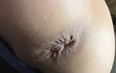 Staceylovesanal Vibrator Ass Cum Self Fuck