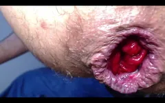 Had Some Good Time, Even with a Swollen Asshole Haha That's What Happens When You Strech Too Frequently