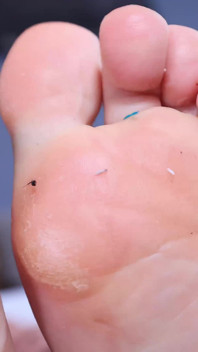 Piedi puzzolenti che stuzzicano con la dea kasin