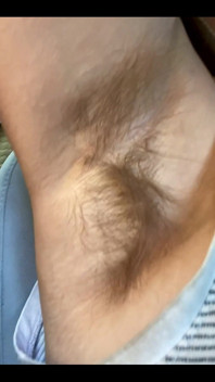 What Do You Think of My Hairy Armpits?