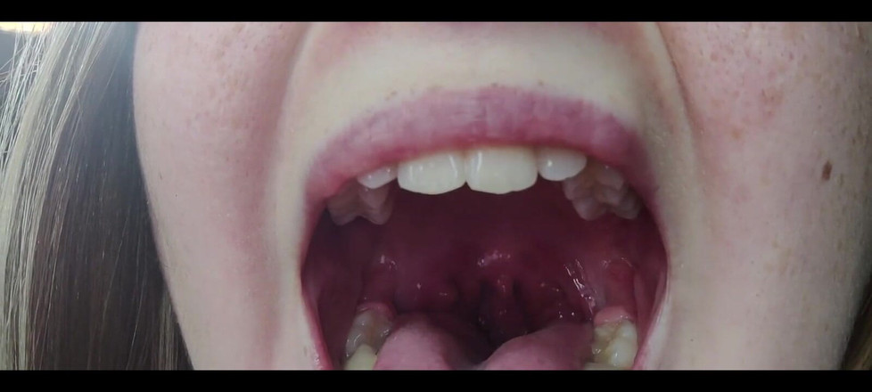 RavenHearth666VIP: Hrdlo fetiš