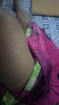 Hot Leg