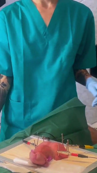 マダム・リー・インと私たちの女による極端な医療CBT