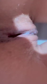Stepdad Checking Out the Condition of My Asshole and Vagina Because He Is a Gynecologist